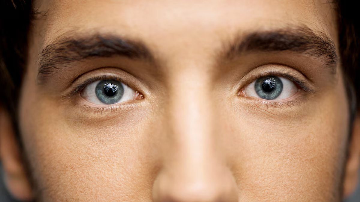 O que é glaucoma e por que é tão importante fazer um exame oftalmológico?