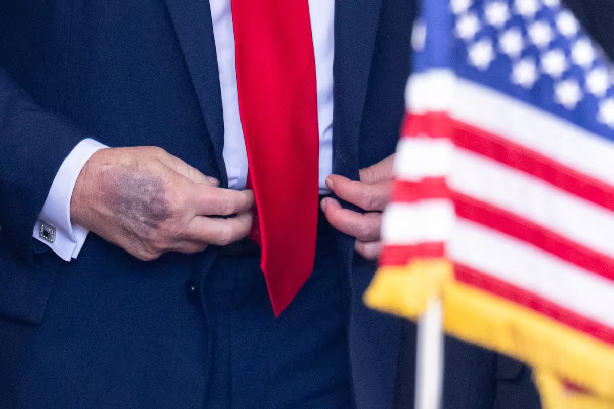 Prestes a completar 80 anos, Trump está a ser submetido a exame médico numa altura em que a sua saúde levanta questões