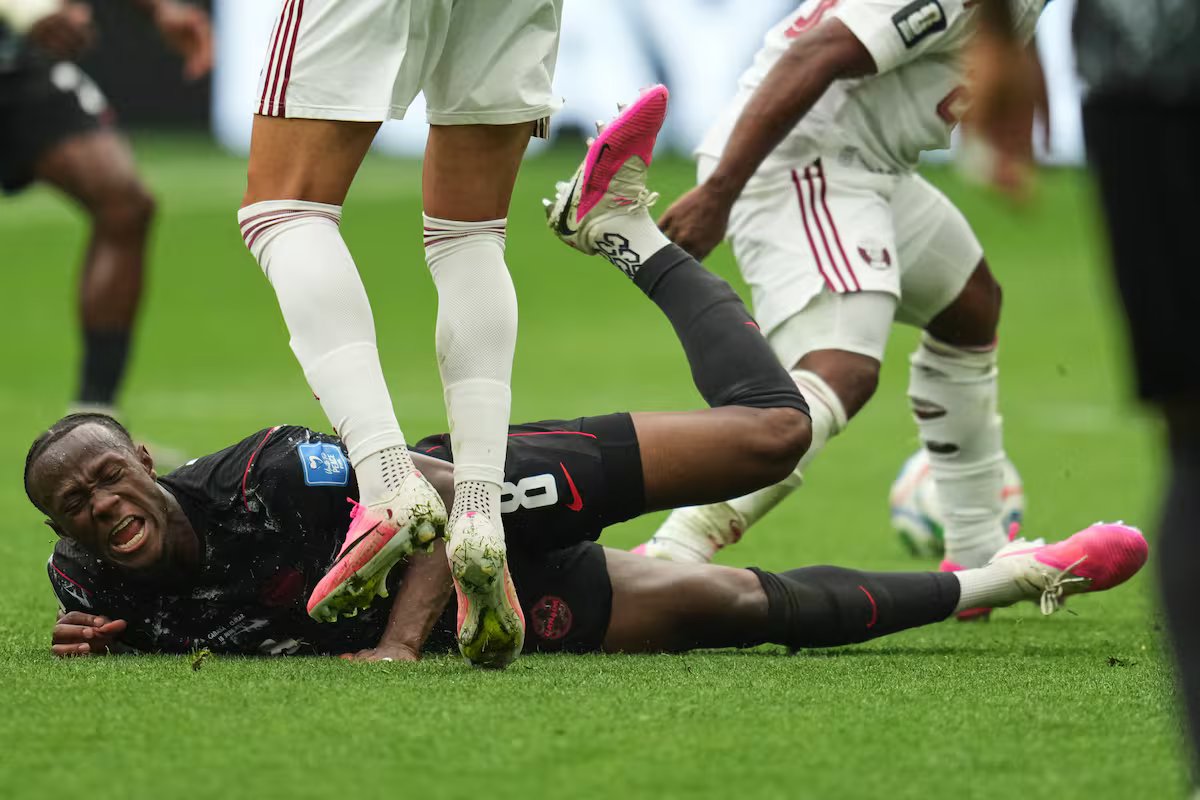 Vídeo do terrível momento de lesão de Kone na partida Canadá-Qatar